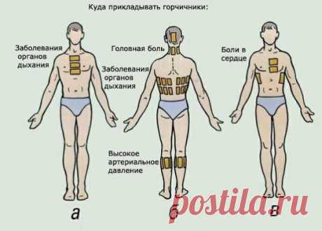 Ставим правильно горчичники.