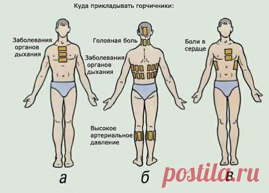 Ставим правильно горчичники.