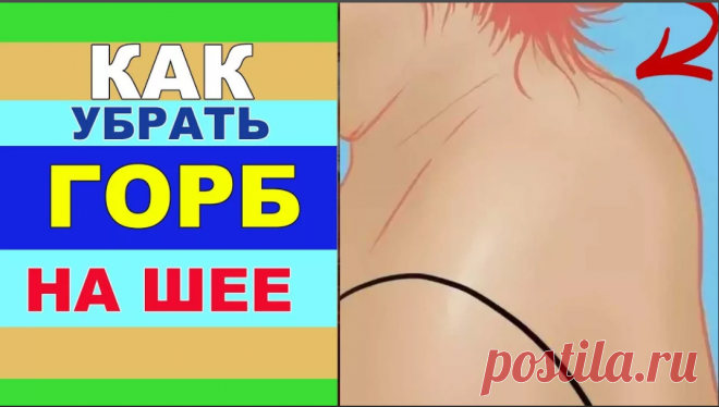 Как быстро убрать горб вдовы