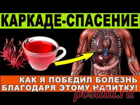 🤔 Напиток КАРКАДЕ 👍: Что Он Делает С Вашим Организмом? Все, Что Вы Должны Знать!