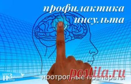 Профилактика инсульта. Ноотропные препараты | Блог Ирины Зайцевой