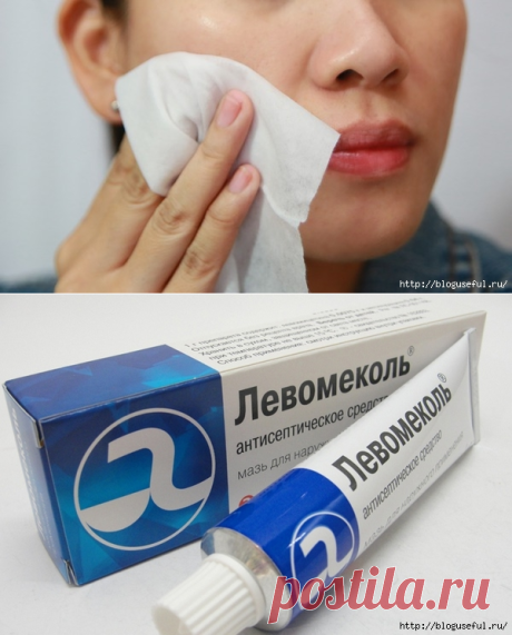 Нехитрые аптечные препараты с большими возможностями