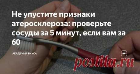 Не упустите признаки атеросклероза: проверьте сосуды за 5 минут, если вам за 60 Статья автора «Академия Вкуса » в Дзене ✍: После 60 лет наш организм начинает подавать знаки о трудностях, которые раньше были незаметны. Атеросклероз — одна из таких «тихих» недугов.