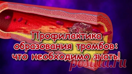 ЧТОБЫ ТРОМБОВ ИЗБЕЖАТЬ,ВОТ ЧТО НАДО ЗНАТЬ

Разжижают кровь (заменяют аспирин), предотвращают закупорку сосудов, поскольку содержат кверцетин и ацетилсалициловую кислоту, очень многие растения: корни лекарственного дягиля и корни солодки, трава донника лекарственного и донниковый мёд, настойка плодов конского каштана, литья и плоды боярышника, настой шишек хмеля, чеснок, таволга ,которая иммеет и другие названия(лабазник вязолистный,белоголовник,медунка) , отвар инжира, яго...