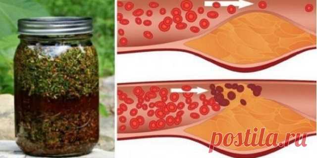 Укроп, мёд и валериана! Всего 1 столовая ложка сотворит чудо с вашими сосудами — Домашние заботы