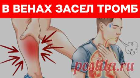 Тромб: врачи рассказали, как распознать и что делать без паники | Игорь Ботоговский | Дзен