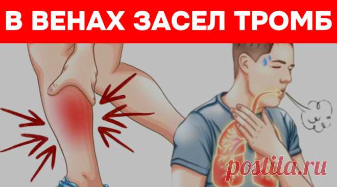 Тромб: врачи рассказали, как распознать и что делать без паники | Игорь Ботоговский | Дзен