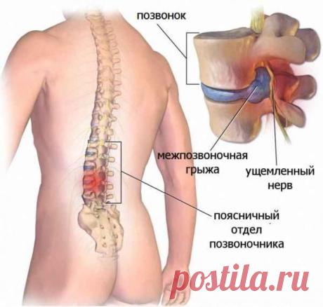(99+) Одноклассники
