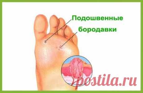 Удалить родинки, черные угри, бородавки, папилломы и пигментные пятна можно естественно и быстро! Это лучшие природные средства! Стоит попробовать! Будучи самым крупным органом в организме человека, кожа действует как барьер, защищая организм от вредной окружающей среды. Тем не менее, большинство людей считают это само собой разумеющимся и осознают его важность, когда появляется нечто вроде бородавок или папилломы! В этой статье основное внимание уделяется природным средст...
