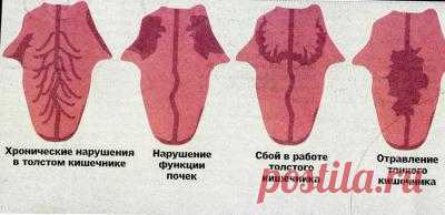 Определение болезни по языку » Женский Мир