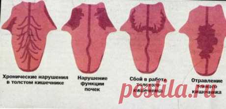 Определение болезни по языку » Женский Мир