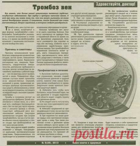 Тромбоз вен