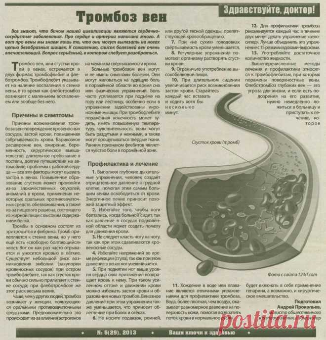 Тромбоз вен