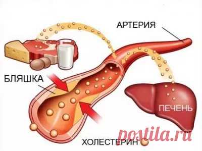 Связь между состоянием печени и повышенным уровнем холестерина. Следствия нарушения работы печени