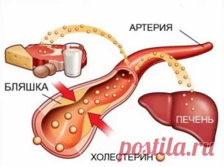 Связь между состоянием печени и повышенным уровнем холестерина. Следствия нарушения работы печени
