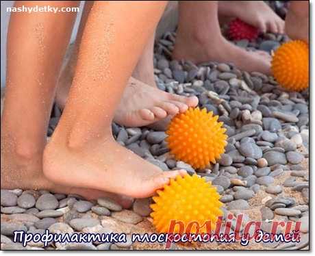 Плоскостопие у детей: симптомы, лечение, профилактика