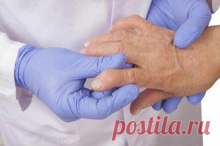 Эти 9 продуктов — убийцы суставов! Врачи настоятельно рекомендуют сменить…