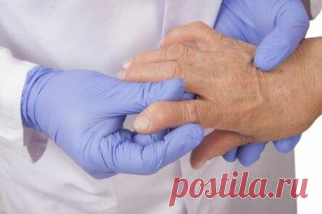 Эти 9 продуктов — убийцы суставов! Врачи настоятельно рекомендуют сменить…