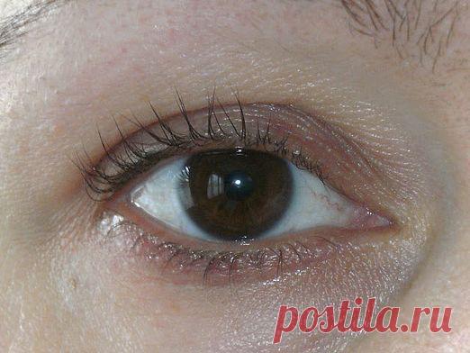 Лечение ресниц в домашних условиях: видео-инструкция по уходу своими руками, как вылечить гипотрихоз, перхоть, гниды, вши у ребенка, что делать, если волоски опалились, болят у корней, цена, фото