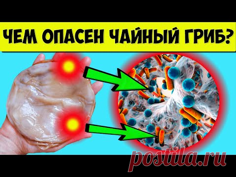 Чайный Гриб Польза или ВРЕД? Чем ОПАСНА комбуча?