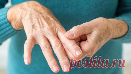 Ревматоидный артрит: симптомы, диагностика, лечение, как лечить ревматоидный артрит у женщин и мужчин