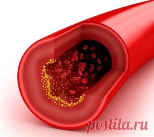 Уникальные методики очищения сосудов мозга, о которых умалчивают врачи