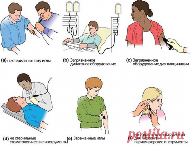 Как в обычной жизни не заразиться гепатитом
Предупрежден – значит вооружен. Информация, знание симптомов такой опасной болезни как гепатит В, может спасти жизнь вам или тем, кого вы любите.
Гепатит B – это заболевание, которое вызывает одноименный вирус, нарушающий нормальную работу жизненно важного органа – печени. Немного теории, чтобы понимать, как не заразиться гепатитом В.