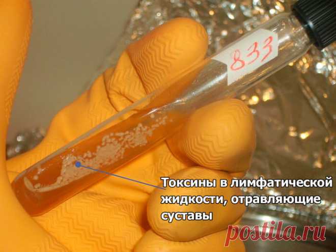 Об этом средстве для суставов запрещено говорить вслух!