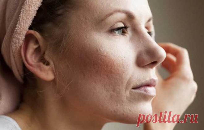 8 советов, как сузить поры — Journal women❜s