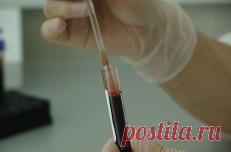 Тройной анализ крови помог ученым точно предсказать риск инфаркта | PGNEWS | Новости Петрозаводска и Карелии | Дзен