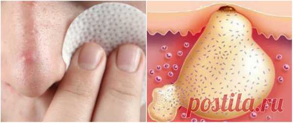 Мазь Вишневского: Копеечное омоложение и очищение кожи | Елена Заболотная | Яндекс Дзен