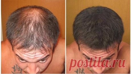 bestnaturalpro.com √ - Posts