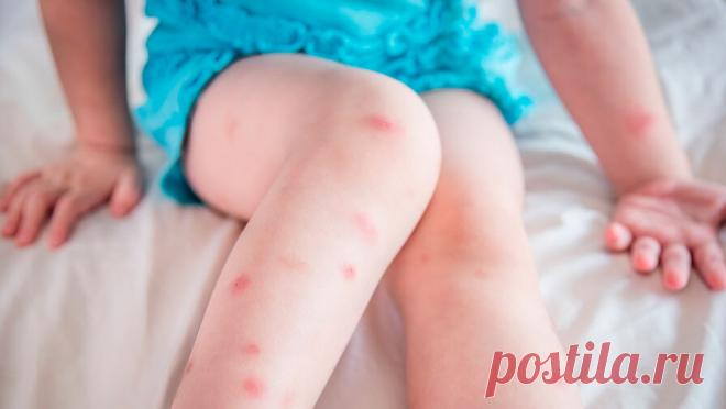 Россияне в Египте столкнулись с самым массовым нашествием клопов за 10 лет. Российские туристы столкнулись с самой массовой атакой клопов в Египте за последние десять лет. Об этом сообщает Life.ru со ссылкой на Telegram-канал SHOT. Россияне обнаружили насекомых в четырех- и пятизвездочных отелях в Хургаде, ...