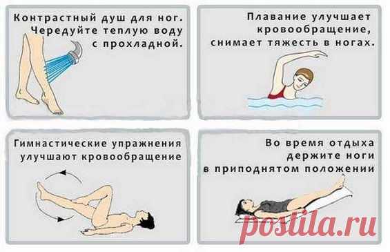 Упражнения при варикозе: каким нагрузкам отдать предпочтение, а каких лучше избегать