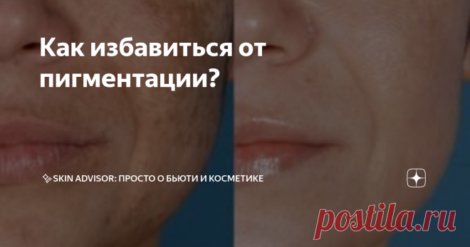 Как избавиться от пигментации? Статья автора «✨BEAUTY PLEASURE: просто о бьюти и косметике» в Дзене ✍: ✨Как избавиться от пигментации Скажу честно: одного средства, волшебной палочки от пигментных пятен нет.