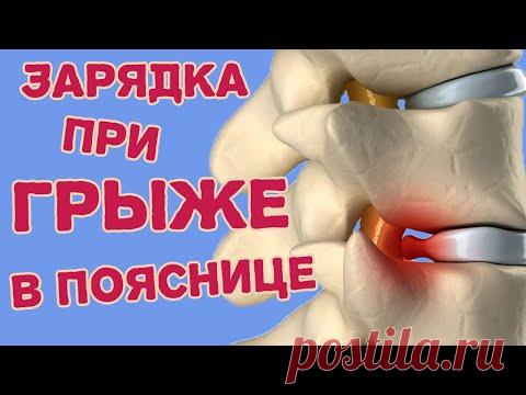 Зарядка при грыже поясничного отдела. Упражнения ЛФК при экструзии и протрузии.
