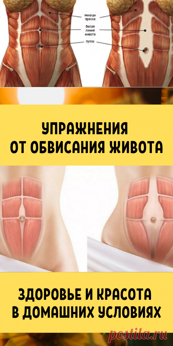 Упражнения от диастаза и обвисания живота для женщин. Здоровье и красота в домашних условиях