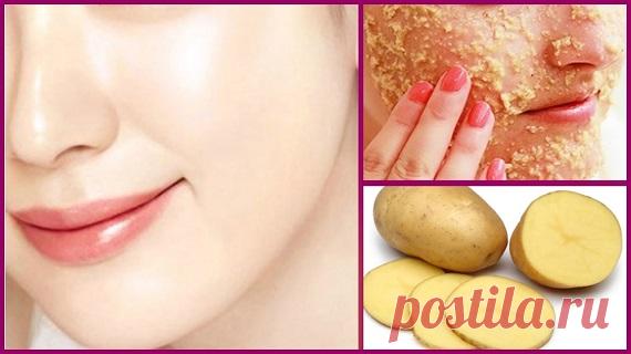 Как сделать картофельную маску для чистой и безупречной кожи - Упражнения и похудение Результаты поражают! Картофель очень полезен для кожи. Картофельный уход помогает лечить угри и другие состояния кожи, такие как темные пятна, морщины, загар и пятна. Растение также работает одинаково хорошо для отбеливания кожи, чистой и прозрачной светящейся и яркой кожи всего за 7 дней. Приготовьте картофельный сок, очистите один картофель, натрите картофель и выжмите сок с помощью …