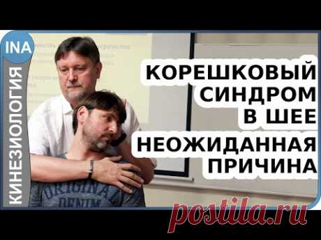 Корешковый синдром в шее. Неожиданная причина. Прикладная кинезиология
