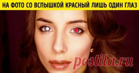 7 совершенно незначительных вещей, которые могут быть сигналом опасной болезни . Милая Я