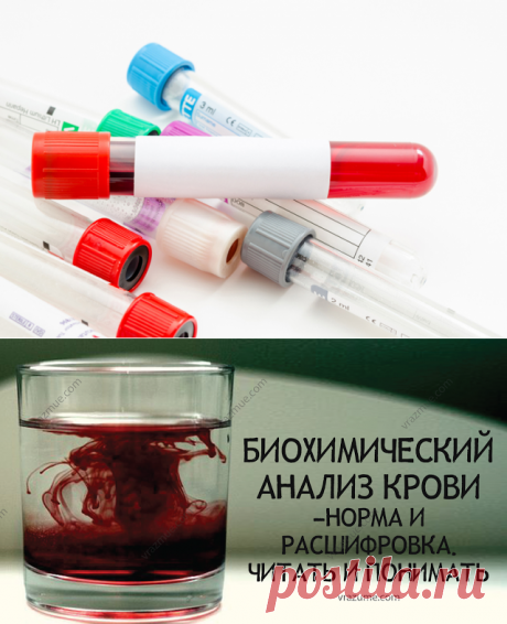VRAZUME: Биохимический анализ крови — норма и расшифровка. Читать и понимать