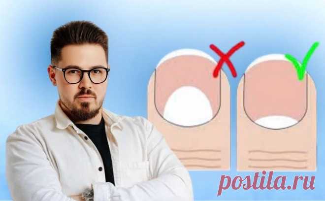 7 проблем с ногтями, которые служат симптомами заболеваний. Сохраните шпаргалку | REHAB.YOU | Дзен