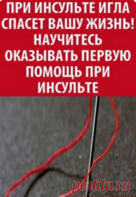 Первая помощь при инсульте: как спасти жизнь простой иглой