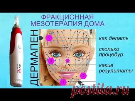 Фракционная мезотерапия (микронидлинг) дома: как делать и зачем.