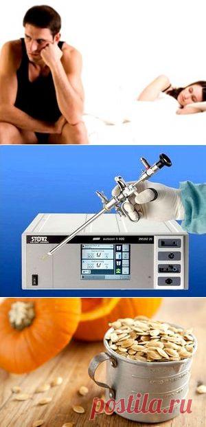 Аденома предстательной железы - симптомы и лечение без операции.