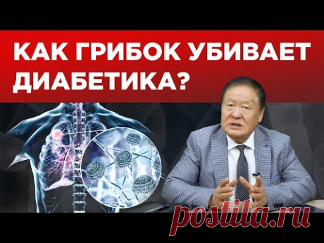 Грибок у диабетика / Как лечить? / Чем опасен?