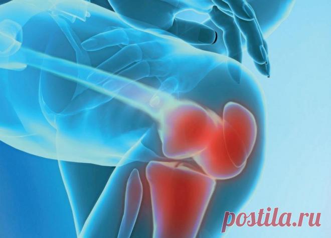 Как вылечить суставы за сутки?