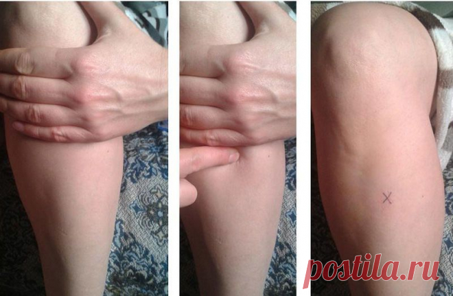 Точка от 100 болезней на вашем теле | Новость | Всеукраинская ассоциация пенсионеров