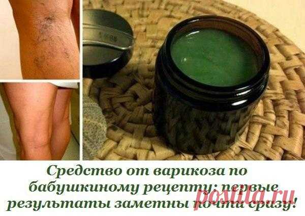Средство от варикоза по бабушкиному рецепту: первые результаты заметны почти сразу!

Генетическая предрасположенность, гормональные изменения, отсутствие должной физической нагрузки, возраст — всё это причины развития варикоза.

Варикоз — это то заболевание, которое нужно вовремя выявить и принять соответствующие меры: чем раньше начнешь, тем лучше.
Показать полностью…