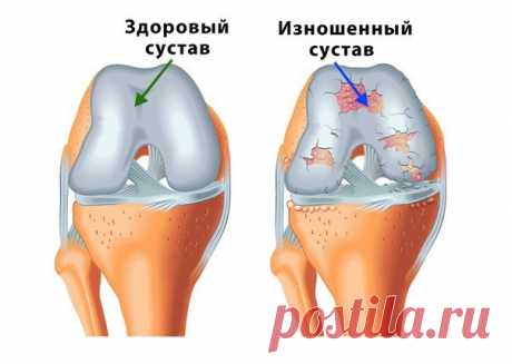 Проблемы со спиной и суставами — прямой путь к инвалидности! Как спасти себя и забыть о боли, рассказывает доктор медицинских наук, профессор Дикуль Валентин Иванович. Читать статью »&gt;